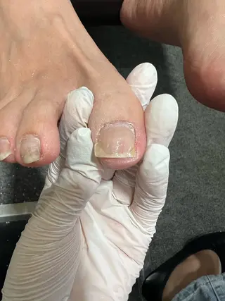 ネイル 巻き爪補正店 堺東店のネイルデザイン