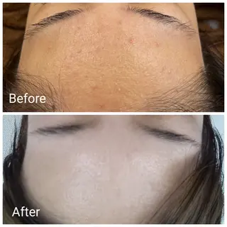 肌質改善Beauty salon Renのエステ・リラクイメージ