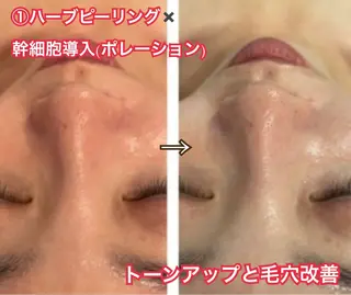 LAESSE 恵比寿所属・毛穴と美白の専門店 LAESSE 恵比寿のエステ・リラクイメージ