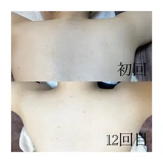 温活beautyサロンNeroli所属・切らない脂肪吸引🔥 Neroliまりこのエステ・リラクイメージ