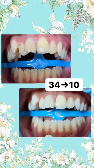 DIA WHITE 奥田のその他イメージ