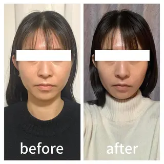 小顔サロン AMYONのエステ・リラクイメージ