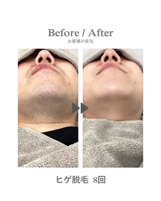 メンズ エステサロンNarcis〜ナルシス〜所属・脱毛＆痩身エステ Narcisのエステ・リラクイメージ