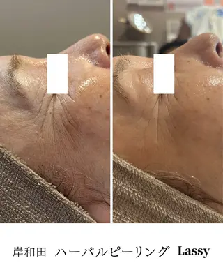 Lassy keikoのその他イメージ