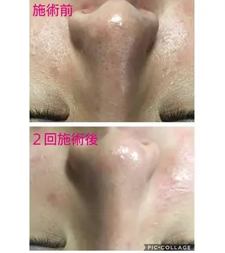 脱毛&肌質改善サロン shandeelのエステ・リラクイメージ