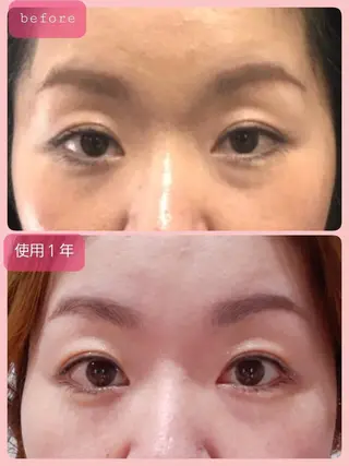 ruby cell hue.のその他イメージ