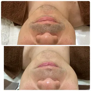 メンズ A/S アズのエステ・リラクイメージ