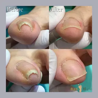 巻き爪補正店 大阪天王寺店のネイルデザイン