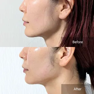 nail RiRi アトレナチュラのエステ・リラクイメージ