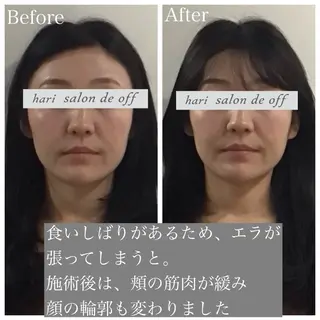 整体×美容鍼灸 鍼灸師Miyanoのエステ・リラクイメージ