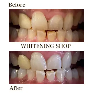 メンズ ホワイトニングショップ静岡葵区店所属・ホワイトニング ショップ葵区静岡駅店のその他イメージ