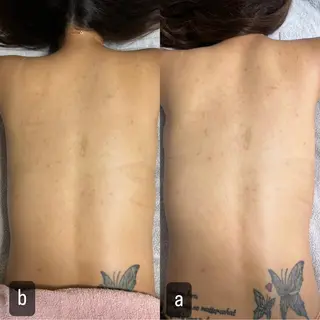 217whitening  room所属・217 ホワイトニングルームのエステ・リラクイメージ