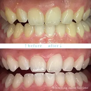 セルフホワイトニングサロンfascimo所属・ホワイトニングサロン fascimo新座店のその他イメージ