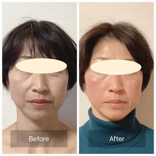 ルコナビューティ所属・小顔・歪み専門 井元 朋子のエステ・リラクイメージ