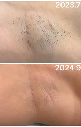 脱毛サロン ミュー松山本店のエステ・リラクイメージ