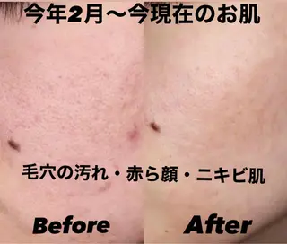 IRISE エステのエステ・リラクイメージ