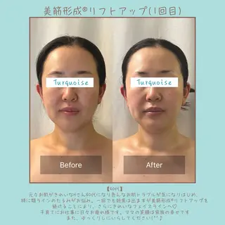 フェイシャルエステ Turquoiseのエステ・リラクイメージ