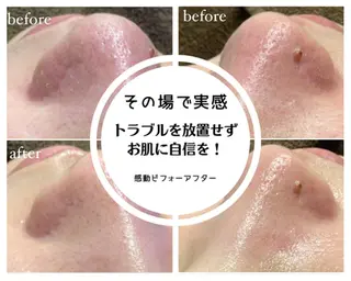 毛穴専門店Bébé 大阪中央店のエステ・リラクイメージ