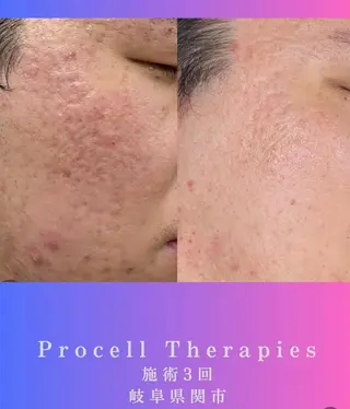 氣楽所属・松下 さゆりのエステ・リラクイメージ