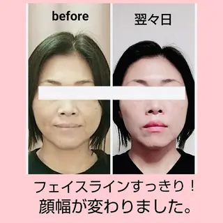 小顔と美肌 まごころエステMatoria所属・小顔 美肌専門 Matoriaのエステ・リラクイメージ