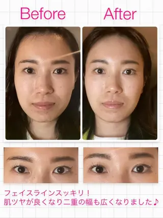 A.mstic 美肌、美ボディ専門店のエステ・リラクイメージ