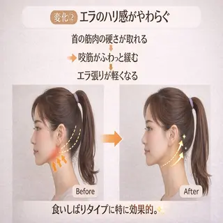 小顔コルギ＆よもぎ蒸しサロンLINKA所属・小顔＆美肌 サロンLINKAのエステ・リラクイメージ