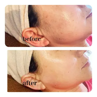 多摩境Beauty Salon  ViVi所属・多摩境ViVi chinamiのエステ・リラクイメージ