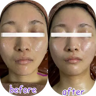 透明感の肌Lino malieのエステ・リラクイメージ