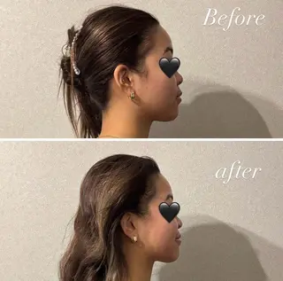 歴14年！劇的 小顔矯正Luanaのエステ・リラクイメージ