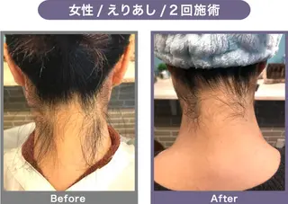 NONOKEKE ノノケケのエステ・リラクイメージ