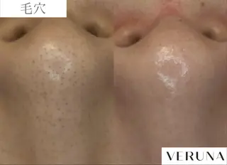 業界初の頭皮ケア 棘スカルプLUNEAのヘアスタイル