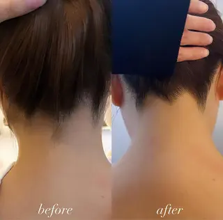 うなじ脱毛/美肌脱毛 LABELのエステ・リラクイメージ