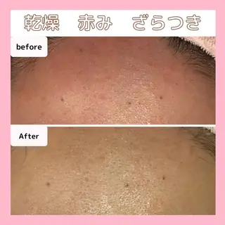 エステサロン　Sブランペタル所属・三沢市エステサロン Sブランペタルのエステ・リラクイメージ