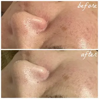 メンズ メナード岐阜茜部 杉浦のエステ・リラクイメージ