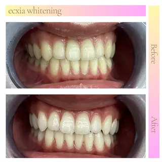 エクシアホワイト 立川南口のエステ・リラクイメージ