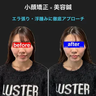 小顔矯正・美容鍼 FLOW鍼灸整体院のエステ・リラクイメージ