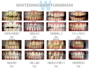 メンズ ホワイトニング ショップ本八幡店のエステ・リラクイメージ