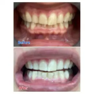 M渋谷店所属・M渋谷 ホワイトニングのエステ・リラクイメージ