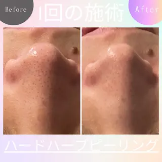 ニキビ改善専門店 d'Albaのエステ・リラクイメージ