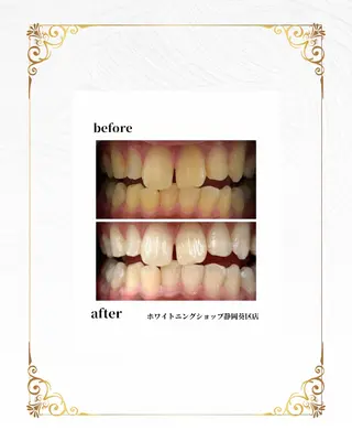 ホワイトニングショップ静岡葵区店所属・ホワイトニング ショップ葵区静岡駅店のその他イメージ