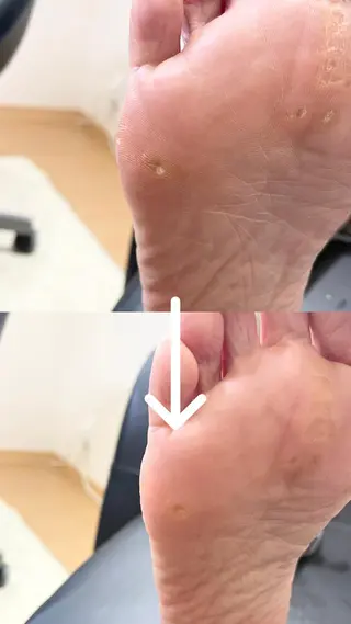 深爪・巻き爪 専門サンセリテのネイルデザイン