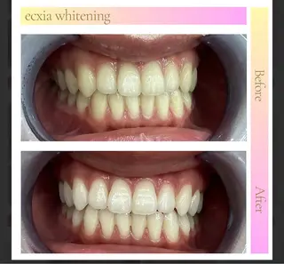 セルフホワイトニング エクシア盛岡中央通店所属・セルフホワイトニング エクシア盛岡あっくんのエステ・リラクイメージ