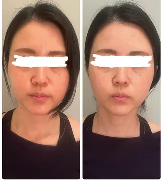 女性ホルモン 専門サロン・ビオナスのエステ・リラクイメージ