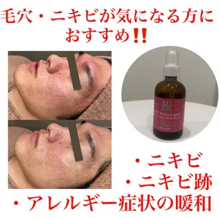 White Calm 天王寺所属・ハーブピーリング White Calmのその他イメージ