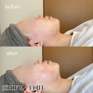 磐田｜LAYLA 一番丁寧な脱毛店のエステ・リラクイメージ