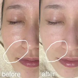 アイブロウ&フェイシャルサロンa‘lm所属・WAX脱毛/肌質改善 眉毛とお肌のサロンのエステ・リラクイメージ