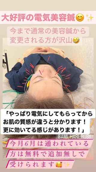 【妊活・美容鍼専門】Aran鍼灸院所属・【美容鍼・不妊専門】 Aran鍼灸院のエステ・リラクイメージ