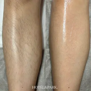 HOTEL&PARK .Moeワックス脱毛のエステ・リラクイメージ