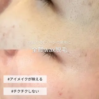 EST BEAUTY所属・顔ワックス脱毛/ ハーブピーリングのエステ・リラクイメージ