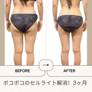 Welina  Pono beauty salon所属・加藤 美有のエステ・リラクイメージ